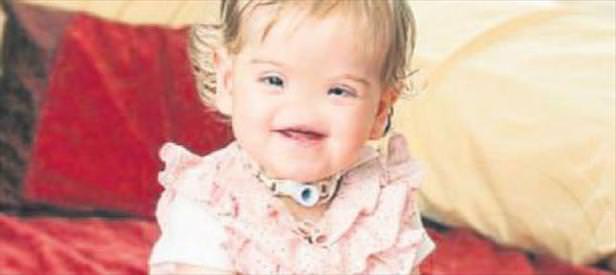 3D yazıcı ile burnuna kavuşacak