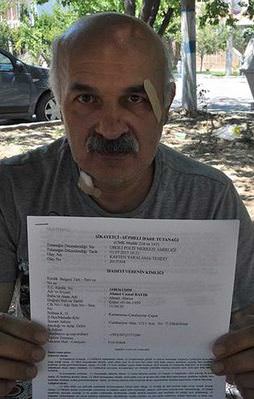 Doktordan hastasına öldüresiye dayak
