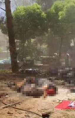 Genç kızın karnında bomba pimi bulundu