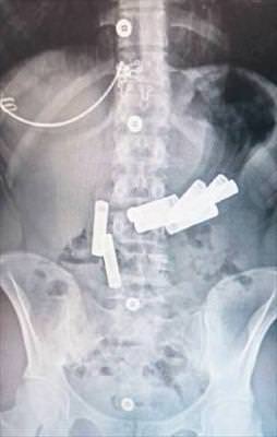 Bu da pilli kızımız