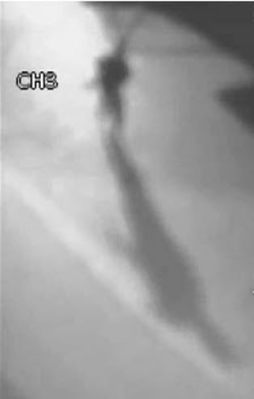 Hain saldırı böyle görüntülendi