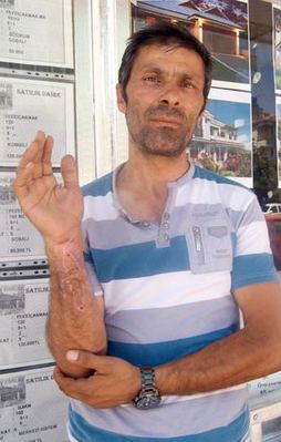 Sigara böreği patladı: 1 yaralı!