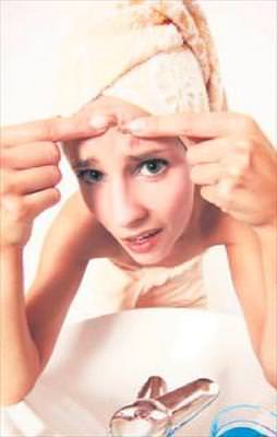 Kabak çörek otu sivilcelerin sonu