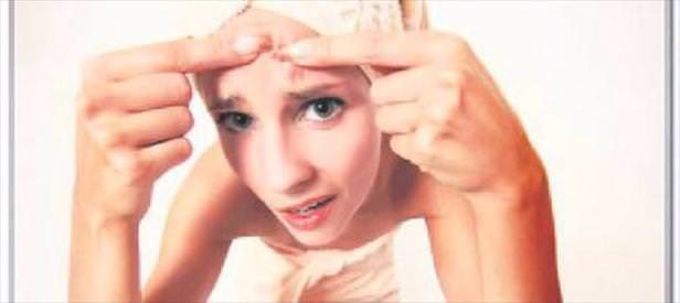 Kabak çörek otu sivilcelerin sonu