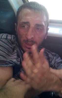 O teröristler AK Parti'ye de saldırmış