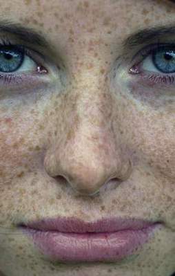 "Floresan lamba da cilt lekesi yapıyor"