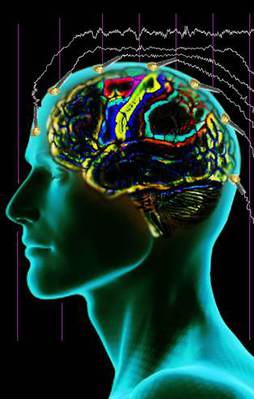 Türk ekip beynin sırlarını çözecek