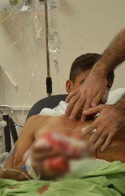 Hazırladığı bomba elinde patladı