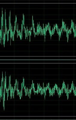 Bilim adamları ses dalgalarıyla beyni kontrol etti