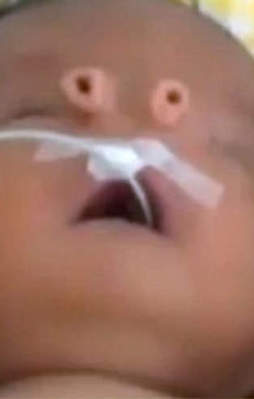 Dünyanın en farklı bebek burnu