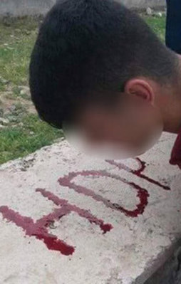Dövdükleri çocuğun kanıyla HDP yazdılar!