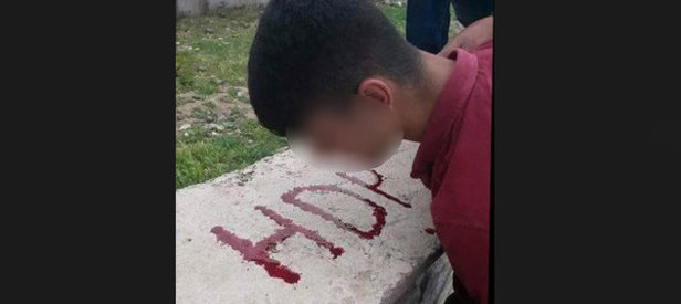 Dövdükleri çocuğun kanıyla HDP yazdılar!