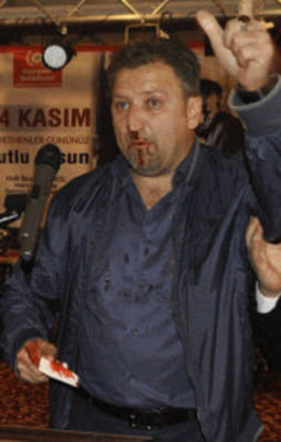 CHP'li özel kalem müdürü öğretmene kafa attı