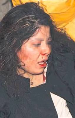 Libyalı kadına tacizci dayağı