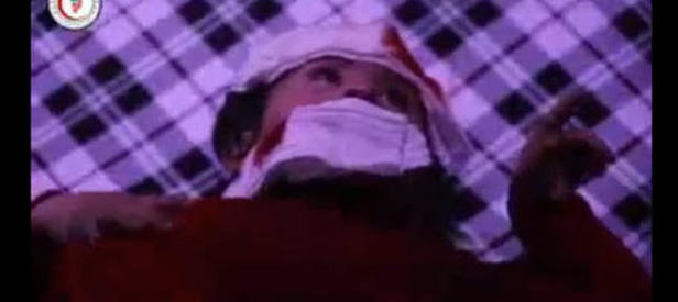 Suriye'de kimyasal katliam