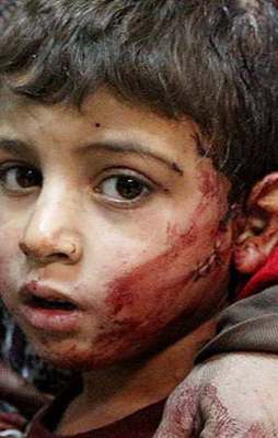 Rus ve Esed güçleri katliam yaptı