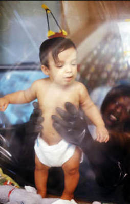 Balon çocuğun inanılmaz hikayesi