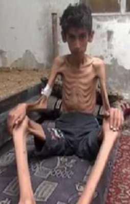 Suriyeli çocuklar açlıktan ölüyor!