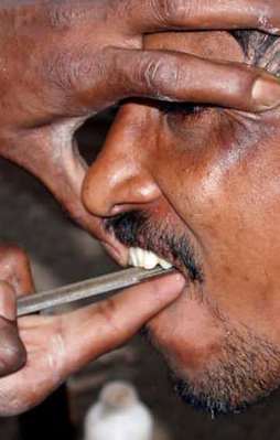 Bu tedavi yöntemini sadece bu ülkede görebilirsiniz