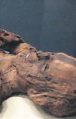 Sapıklığın böylesi