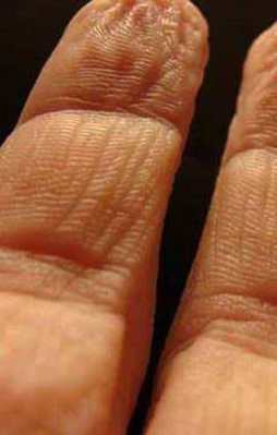 Parmaklar suda neden buruşur? İşte mucizenin cevabı