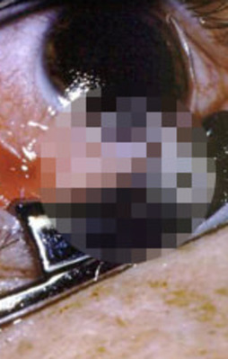 Gözünden çıkan şey şoke etti!