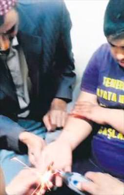 Sıkışan yüzüğü itfaiye çıkardı