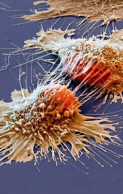 Tüm dünya bu şey için uğraşıyor!