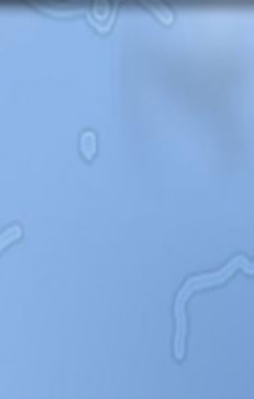 Gözünüzde gördüğünüz bu lekeler bakın neymiş!