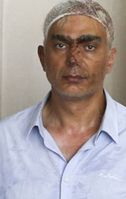 O FETÖ'cü terörist de kıvırdı