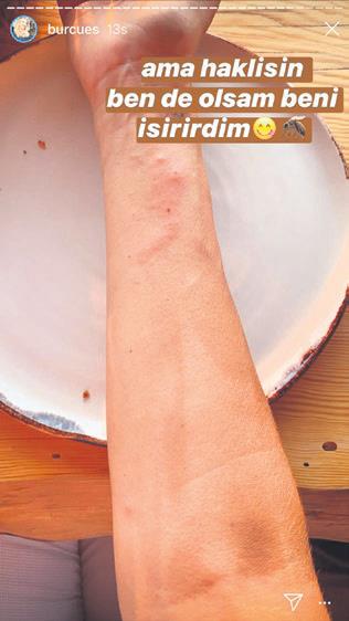 burcuyu-yediler-1593379957289.jpeg Burcu Esmersoy'un keyfini sinekler kaçırdı-1