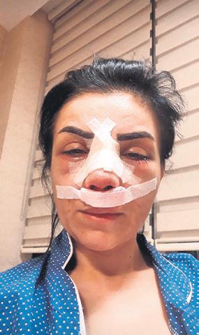 Estetik faciası! Genç kadın hukuk savaşı başlattı-1