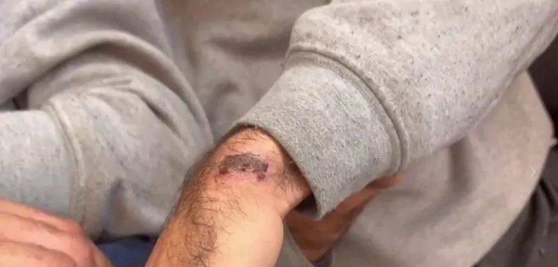 soykirimci-israilden-alcakligin-nirvanasi-filistinli-esirlere-mide-bulandiran-iskence-cinsel-saldiri-tecavuz-d-1718826494208.jpeg Soykırımcı İsrail'den alçaklığın nirvanası! Filistinli esirlere mide bulandıran işkence: Cinsel saldırı, tecavüz, darp...-5