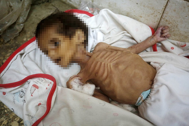  Gazzeli bebek Jodi el-Masri, tedavi gördüğü Deyr Belah kentindeki Aksa Şehitleri Hastanesi'nde hayatını kaybetti, AA