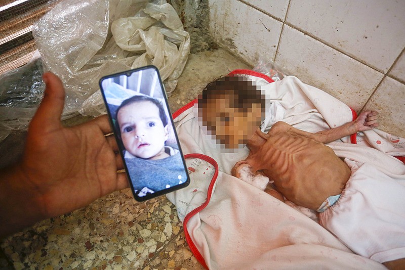  Gazzeli bebek Jodi el-Masri, tedavi gördüğü Deyr Belah kentindeki Aksa Şehitleri Hastanesi'nde hayatını kaybetti, AA