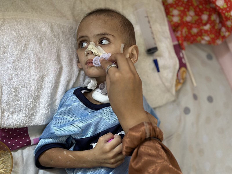 İsrail'in Gazze Şeridi'nin kuzeyine düzenlediği saldırılarda tüm ailesini kaybeden 3 yaşındaki Ömer el-Hams, aldığı yaralarla yaşam mücadelesi veriyor. Vücudunun çeşitli yerlerinde kırıklar olan ve yetersiz beslenme sorunu yaşayan Hams, Han Yunus'taki Nasır Hastanesi'nde tedavi görüyor, AA