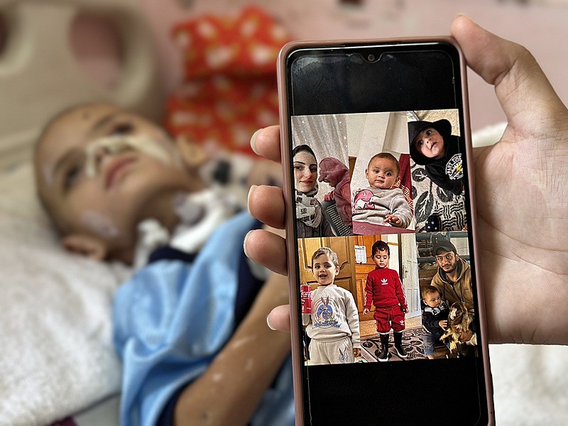 İsrail'in Gazze Şeridi'nin kuzeyine düzenlediği saldırılarda tüm ailesini kaybeden 3 yaşındaki Ömer el-Hams, aldığı yaralarla yaşam mücadelesi veriyor. Vücudunun çeşitli yerlerinde kırıklar olan ve yetersiz beslenme sorunu yaşayan Hams, Han Yunus'taki Nasır Hastanesi'nde tedavi görüyor, AA