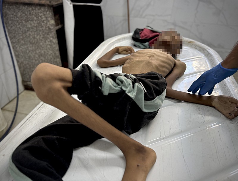 Gazze'de açlık ve yetersiz beslenme can almaya devam ediyor: 40 günlük bebek şehit oldu