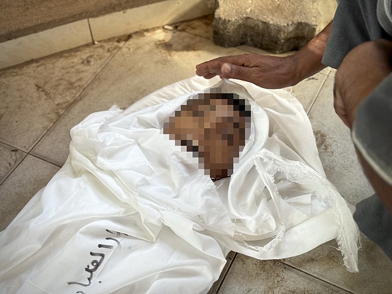 Gazze'de açlık ve yetersiz beslenme can almaya devam ediyor: 40 günlük bebek şehit oldu