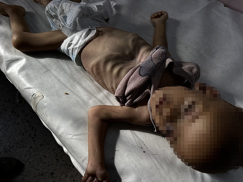 İsrail'in yoğun kuşatma ve kısıtlamalarla temel gıda erişimini engellediği Gazze Şeridi'nde, 16 aylık Muhammed Asfur isimli çocuk, yetersiz beslenme nedeniyle hayatını kaybetti, AA