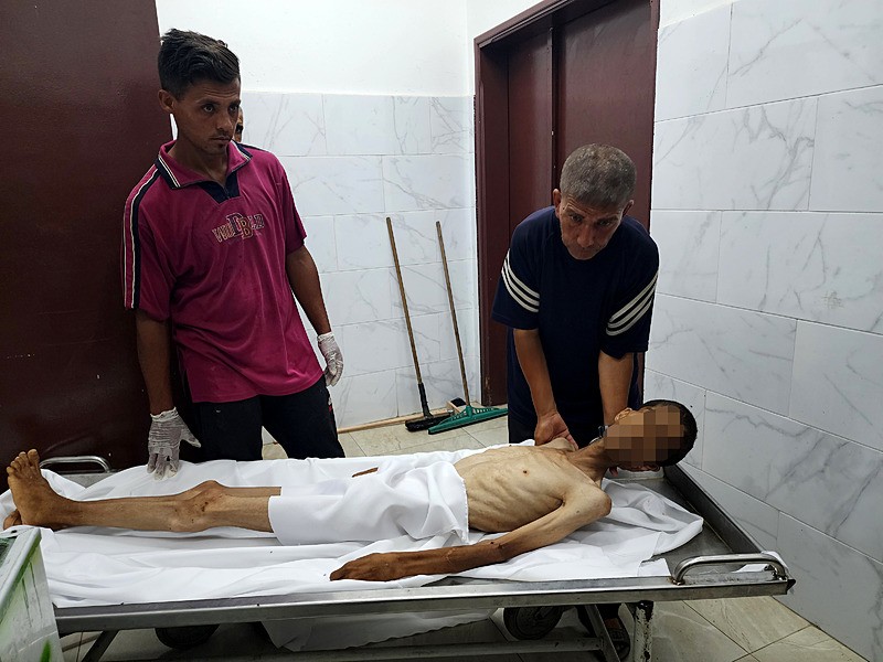 Gazze açlıktan ölüyor! Son 24 saatte 5 kişi daha gıda yetersizliğinden hayatını kaybetti-1
