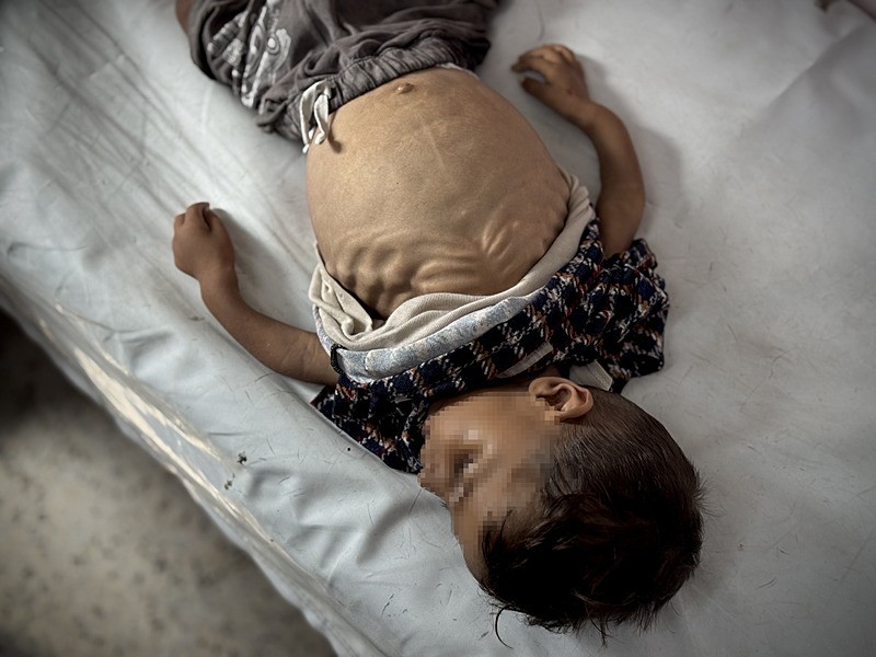 Gazze Şeridi'ndeki ağır abluka ve gıda ile ilaç yetersizliği nedeniyle şiddetli yetersiz beslenme yaşayan 5 yaşındaki Cemal Fadi Adnan en-Neccar, tedavi gördüğü Han Yunus'taki Nasır Tıp Merkezi'nde hayatını kaybetti, AA