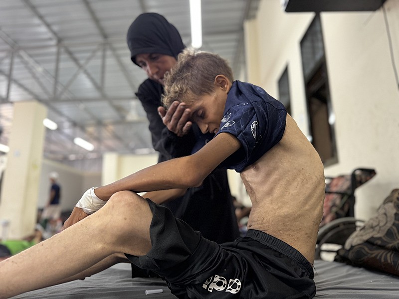 Gazze'de çocuklar açlıktan ölüyor (AA)