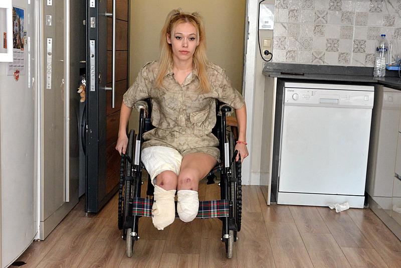 En mutlu günü kabusa döndü! Evlilik yıl dönümünde bacaklarını kaybetti (takvim foto arşiv)