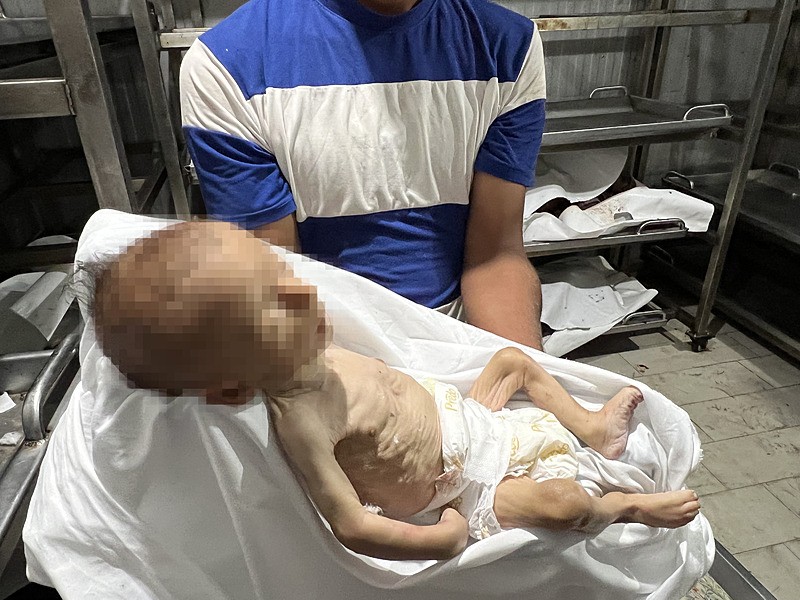 Gazze’de yetersiz beslenme nedeniyle bir bebek daha hayatını kaybetti (AA)