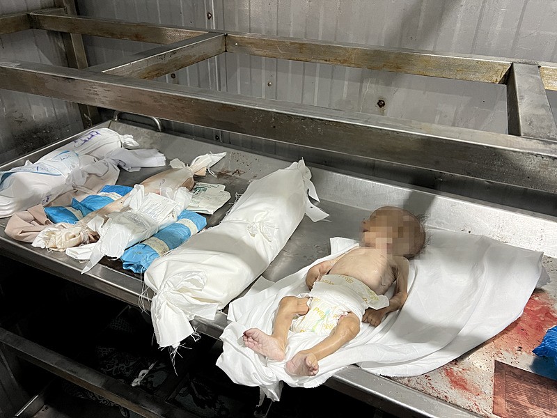 gazze-her-dakika-yok-oluyor-25-aylik-bebek-acliktan-sehit-oldu-insanligin-tukendigini-gosteren-kare-1759049925264.jpeg Gazze’de yetersiz beslenme nedeniyle bir bebek daha hayatını kaybetti (AA)