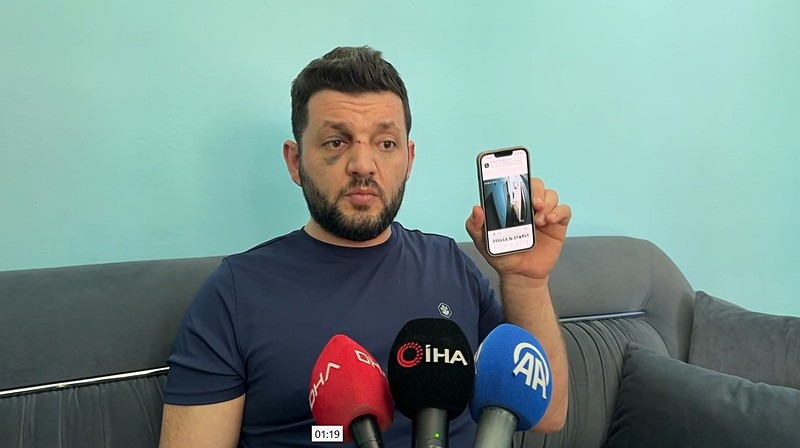 Türkiye Yalova'daki komşu kavgasını konuşuyor: Muhammet Baca ve 14 aylık bebeğin yaralandığı olaya ilişkin görüntüler ortaya çıktı-7