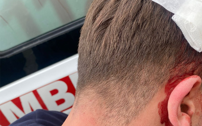 Bursaspor 3 puan aldı ama ölümden döndü!-3