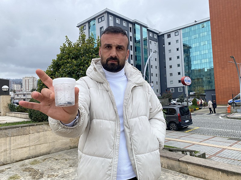 Rize'de inanılmaz olay: 5 yaşındaki çocuğun burnundan tırnak makası zinciri çıktı-4