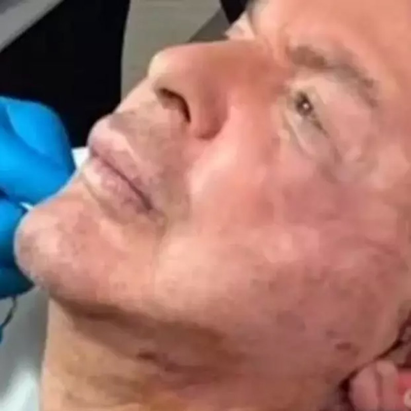 kusum-aydin-son-halini-paylasti-iste-estetik-sonrasi-yeni-hali-1774938863373.jpg Kuşum Aydın son halini paylaştı! İşte estetik sonrası yeni hali-5